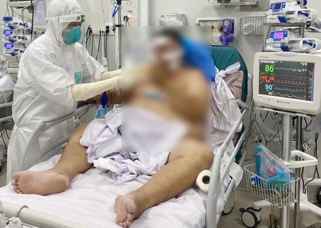 TPHCM: Bệnh nhân Covid-19 nặng 140kg thoát chết sau trụy tim-1