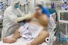TPHCM: Bệnh nhân Covid-19 nặng 140kg thoát chết sau trụy tim