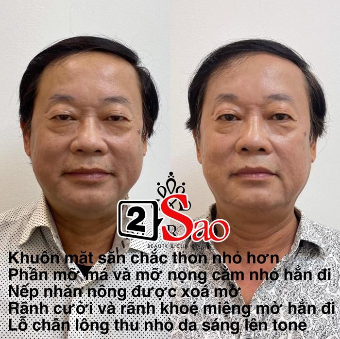 Vy Oanh lộ ảnh không tự nhiên đẹp như nhiều người vẫn tưởng-7