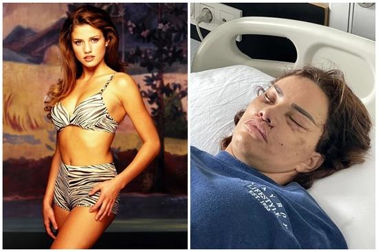 Người mẫu xứ Anh nghiện thẩm mỹ: Cả người cắm đầy ống dịch, mặt biến dạng