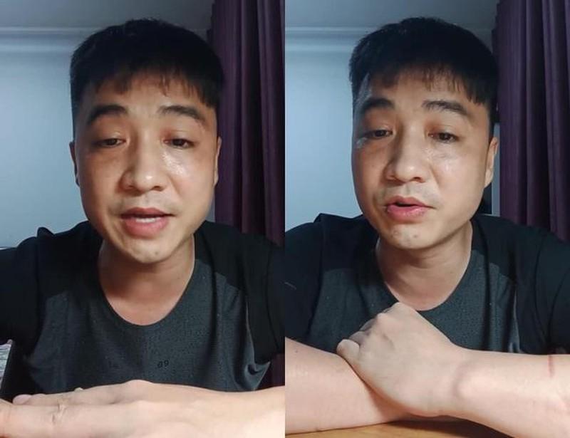 Mũi Hoàng Yến cao - xịn - mịn như chưa từng bị chồng cũ đấm-4