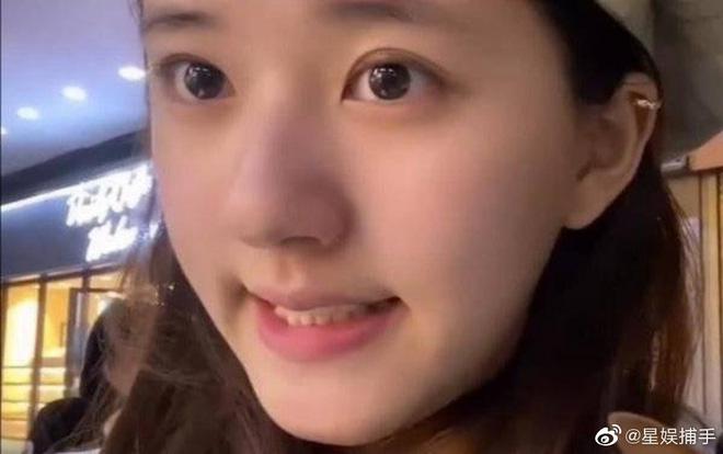 Triệu Lộ Tư gây sốc với gương mặt mộc trước khi trang điểm-6