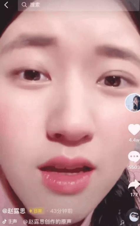 Nghi vấn Triệu Lộ Tư ngã dập mặt vì mải... bắt chim-2