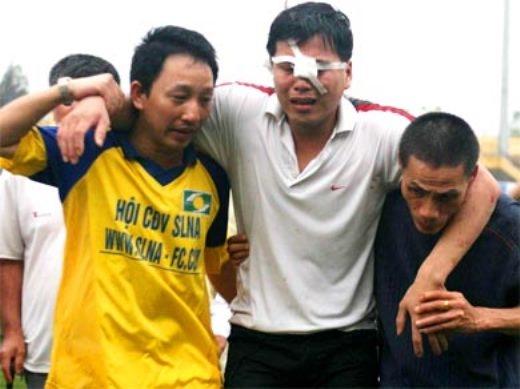 Cổ động viên đổ máu xem chung kết Euro-6