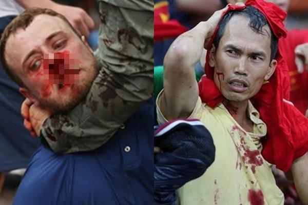 Loạt luân lưu thảm họa khiến Anh không thể viết nên lịch sử Euro-1