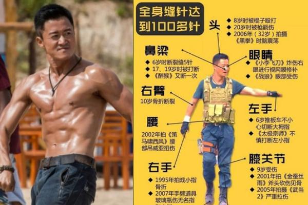 Ngô Kinh có hơn 100 mũi khâu trên người