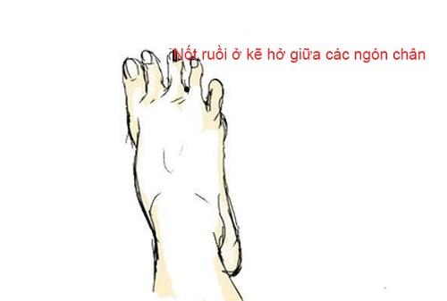Nốt ruồi ở 3 vị trí trên bàn chân: Tiền bạc rủng rỉnh, cuộc đời sung sướng-1