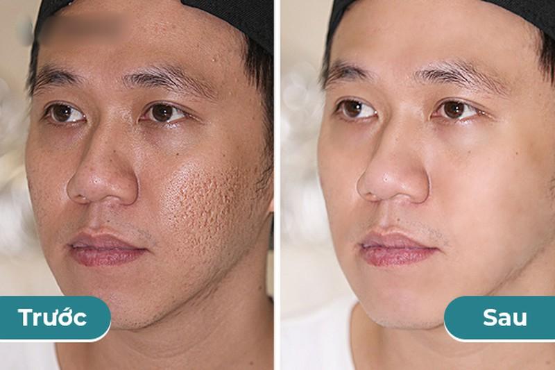 Bạn gái Anh Đức khoe cảnh thân mật và than thở nhan sắc bạn trai-2