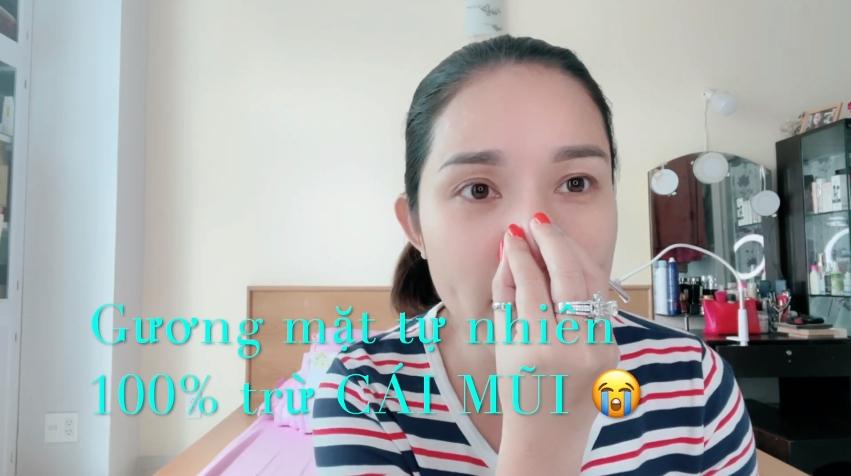 Bà mối Cát Tường kể hành trình sửa mũi 5 lần và biến chứng đáng sợ-1