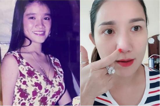 'Bà mối' Cát Tường kể hành trình sửa mũi 5 lần và biến chứng đáng sợ