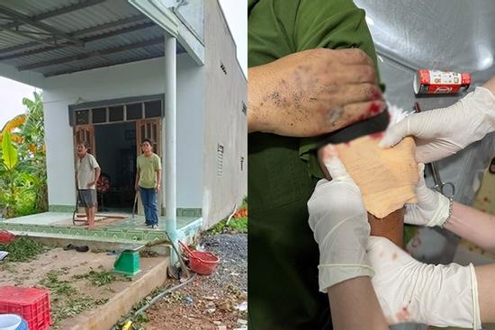 'Thông chốt' kiểm dịch, 2 cha con vác rựa chém suýt lìa tay cán bộ