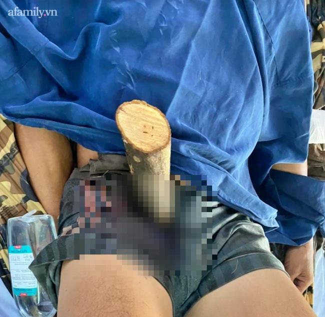 Ngã từ cao xuống, người đàn ông bị cọc bần đâm xuyên hạ vị-1