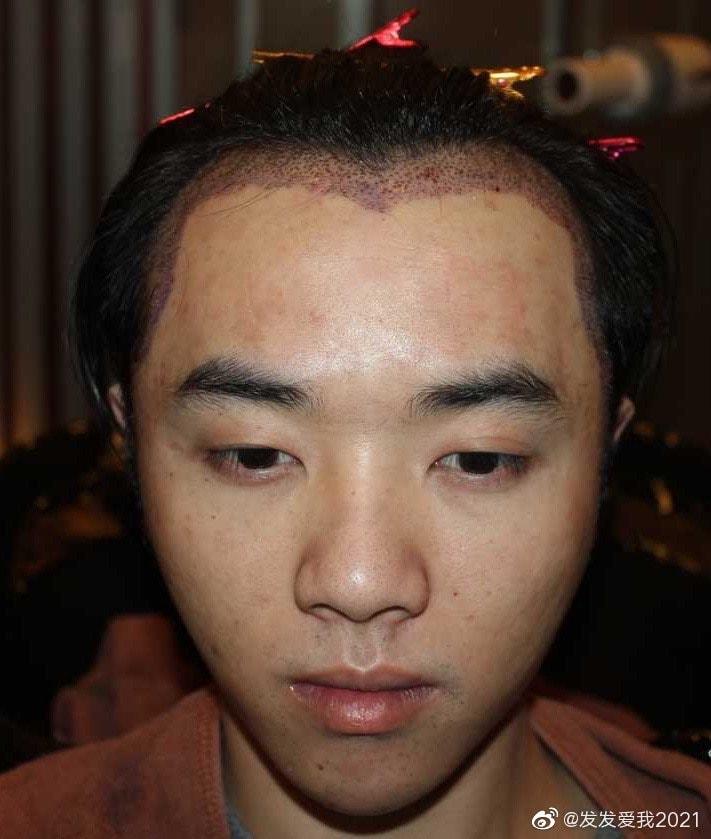 Bồ cũ bóc Hoa Thần Vũ dao kéo, ngoại tình với Trương Bích Thần-5