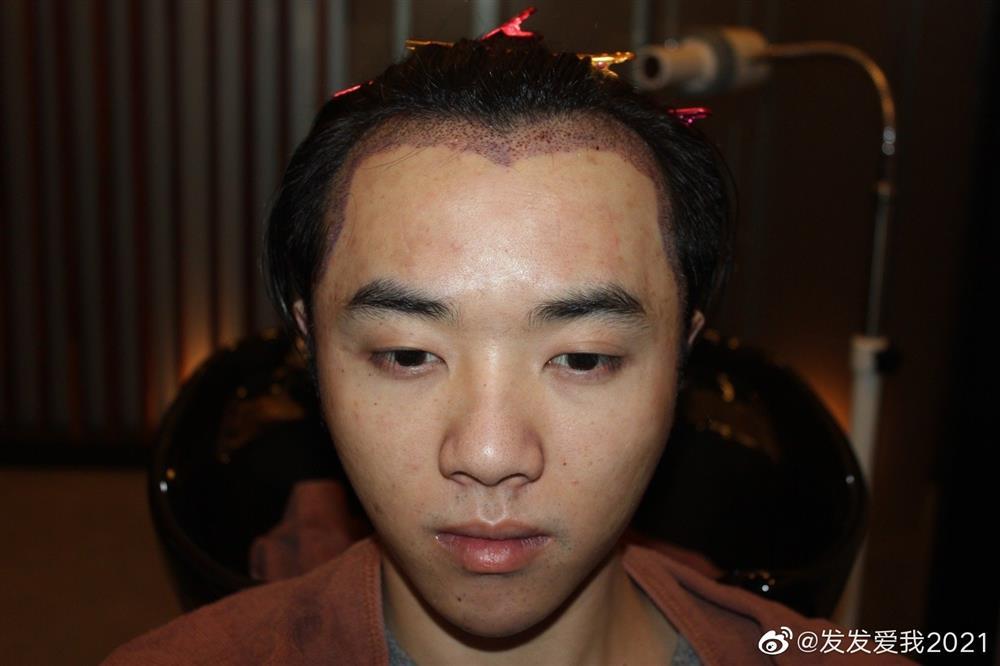 Bồ cũ bóc Hoa Thần Vũ dao kéo, ngoại tình với Trương Bích Thần-6