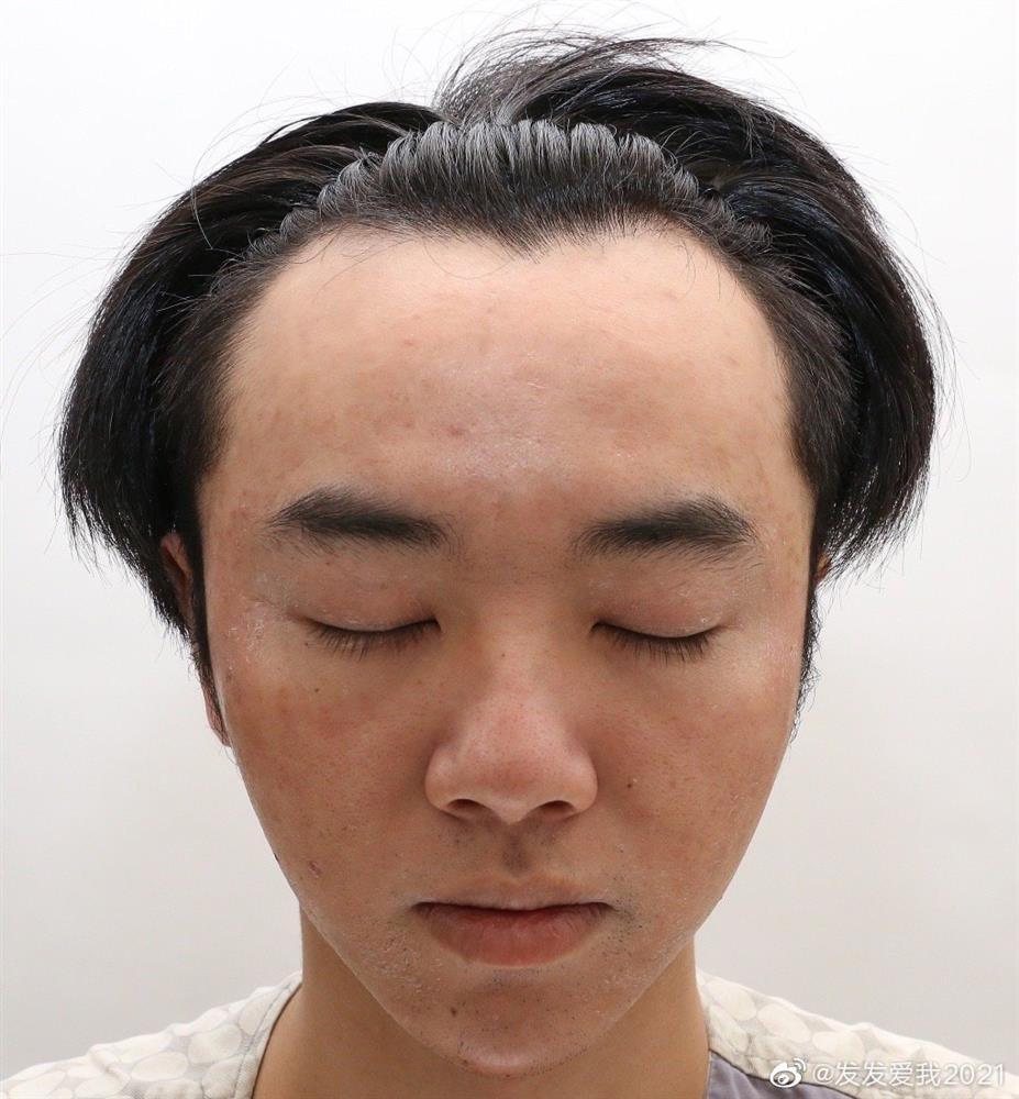 Bồ cũ bóc Hoa Thần Vũ dao kéo, ngoại tình với Trương Bích Thần-7