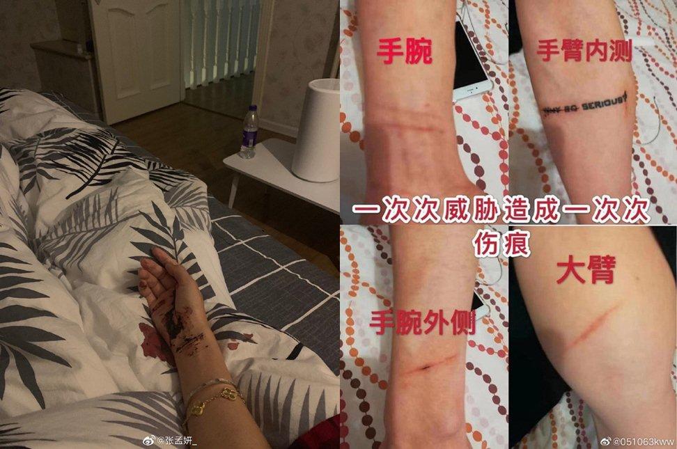 Mỹ nam có bạn gái nhưng ngủ với đàn ông, mắc bệnh lây nhiễm, sự nghiệp chết đứng-5