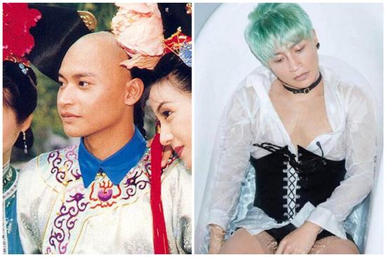 Trần Chí Bằng bị bỏng nặng phải dừng đóng phim, sống chật vật ở tuổi xế chiều
