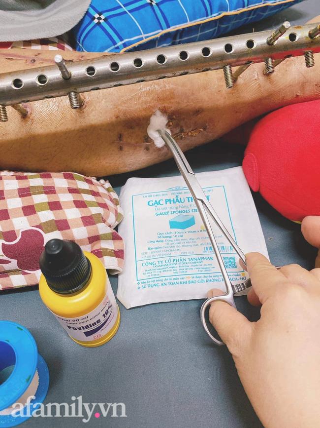 Cặp đôi ly thân, chồng gặp tai nạn vợ gạt hết tất cả chăm sóc rồi cứu cả cuộc hôn nhân-3