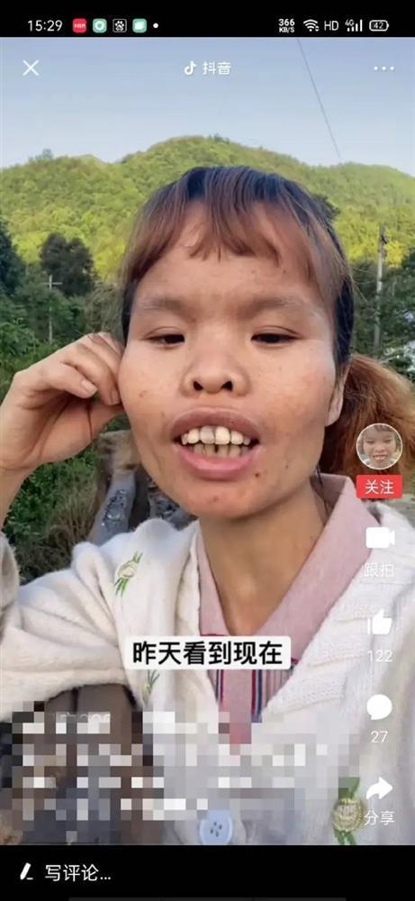 Người phụ nữ xấu nhất Tiktok giàu kếch xù, nhìn chồng và con gái mới kinh ngạc-2