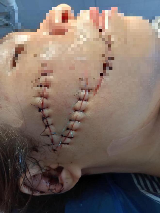 Clip: Vợ xin làm tăng ca, chồng nghi nói dối rút dao chém nát mặt vợ-4