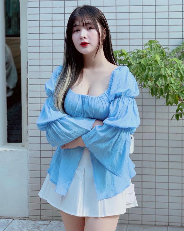 Quỳnh Alee bất ngờ đăng ảnh truyền nước biển, chuyện gì đây?-4