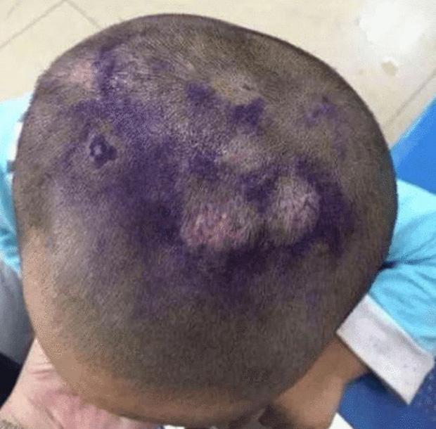 Cháu trai trùm kín đầu lúc ngủ, bà nội khóc ngất khi biết do mẹ kế mà ra-3