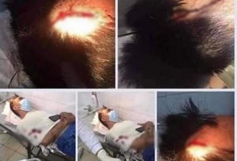 Vĩnh Phúc: Nghi vấn ghen tuông, vợ chém chồng hơn chục nhát-1