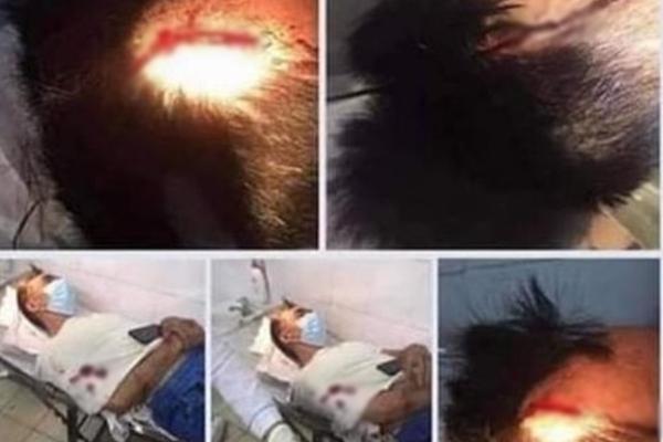 Chồng chém vợ tử vong rồi tự sát, con gái vào can dính trọng thương-2