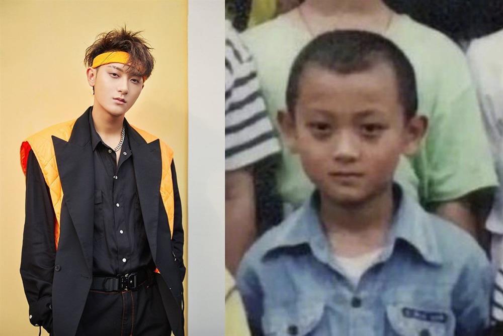 Hoàng Tử Thao số nhọ: Hết bị soi mắt thâm đến... viêm cánh-2