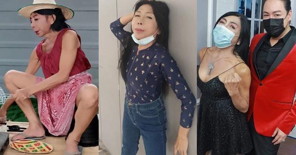 Gương mặt nhàu của gái già chuyển giới có thật sự được cải thiện?-4