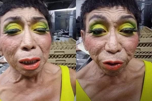 Gương mặt nhàu của gái già chuyển giới có thật sự được cải thiện?-2