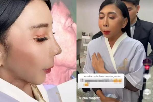 Gương mặt nhàu của gái già chuyển giới có thật sự được cải thiện?-1