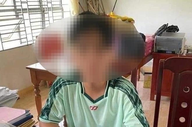 Khởi tố nam sinh nghi sát hại thầy hiệu trưởng trường THCS Hoàng Diệu-1