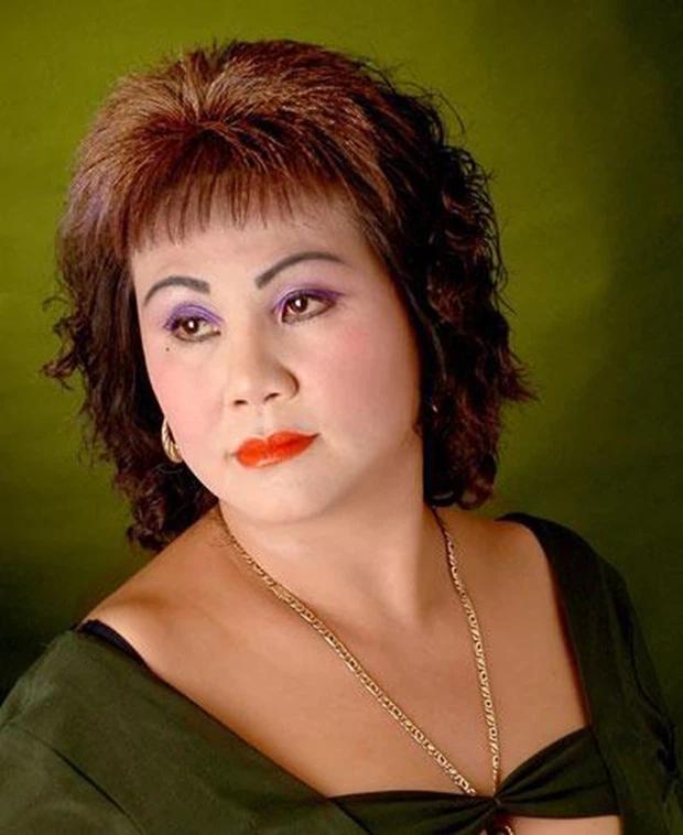 Nghệ sĩ Hoàng Lan ra sao sau phẫu thuật lưng hoại tử, lộ cả xương sống?-2