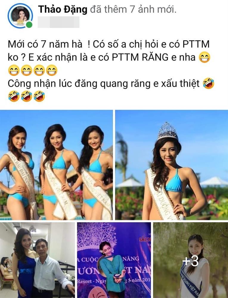 Hoa hậu Đặng Thu Thảo thừa nhận phẫu thuật thẩm mỹ-1