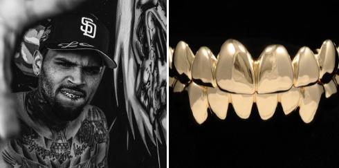 Chris Brown phủ kín 28 chiếc răng bằng vàng-1