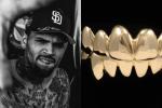 Chris Brown phủ kín 28 chiếc răng bằng vàng