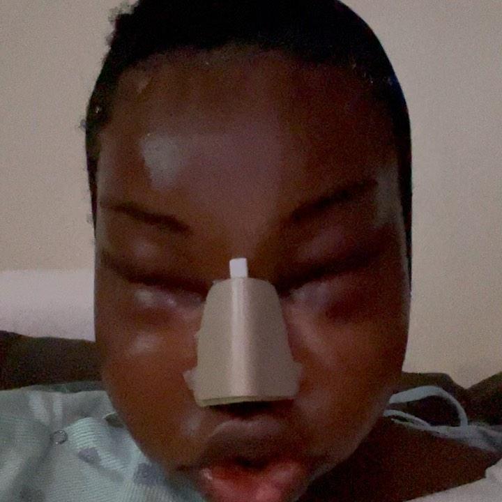 Người kế nhiệm Hương Giang đập mặt, biến dạng nhận không ra-1