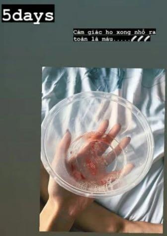 Khả Ngân lên tiếng về loạt ảnh da bọc xương, ho ra máu-2