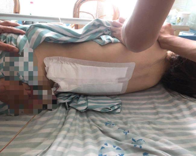 Kinh hoàng người phụ nữ nhảy khỏi lầu 2 thoát sự bạo hành của chồng-2