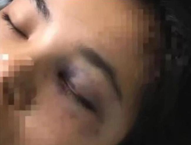 Kinh hoàng người phụ nữ nhảy khỏi lầu 2 thoát sự bạo hành của chồng-4