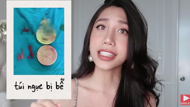 Đi độ loa, Rich Kid chuyển giới phát hiện túi silicon cũ vỡ toang-1