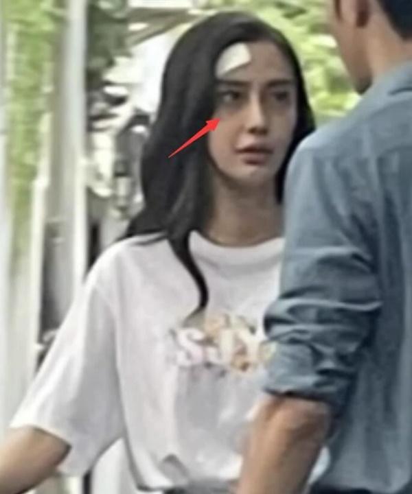 Angela Baby lộ quầng thâm đen sì như mắt gấu trúc trên phim trường-4