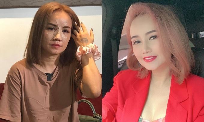 Hoàng Yến hoảng loạn khi chồng cũ tố ác độc, không cho gặp con-2