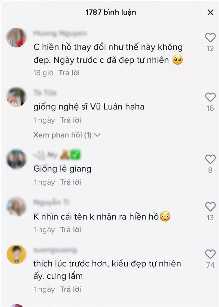 Mặt đơ còn dùng app, Hiền Hồ bị chê sửa nát mặt giống Lê Giang-7