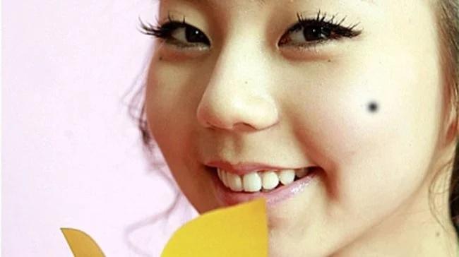 7 nốt ruồi phá tướng khiến tiền bạc hao tổn, tình duyên ly tán-1