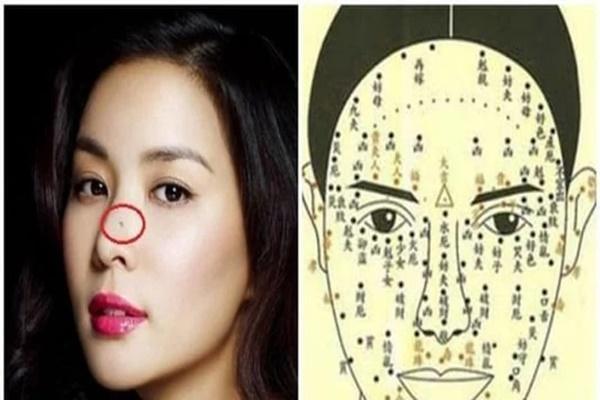 Má lúm đồng tiền, nốt ruồi trước ngực nhất định phải giữ gìn-2