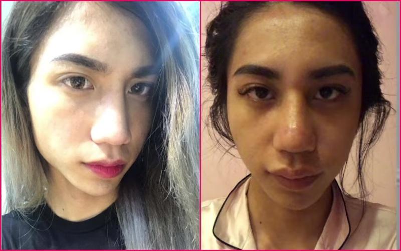 Rich kid chuyển giới tốn 162 triệu sửa mũi 6 lần, bị so sánh với yêu tinh-6
