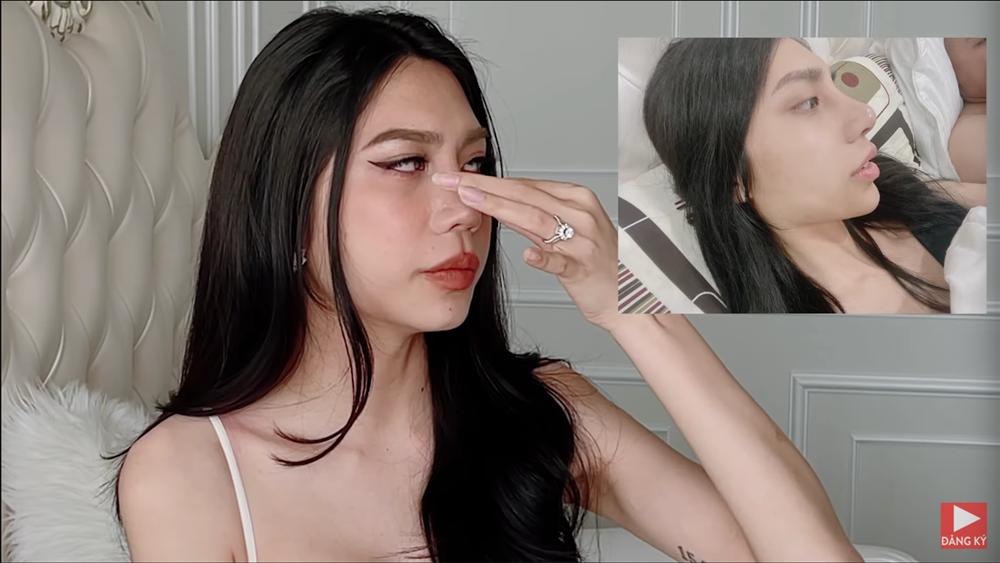 Rich kid chuyển giới tốn 162 triệu sửa mũi 6 lần, bị so sánh với yêu tinh-1