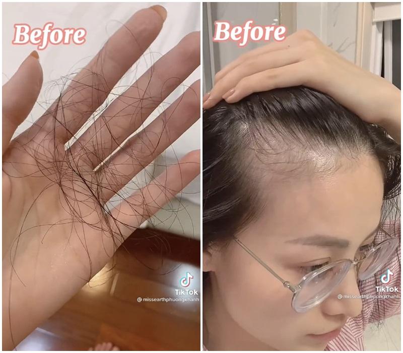 Hoa hậu Phương Khánh bật mí trị hói bằng nước vo gạo-3